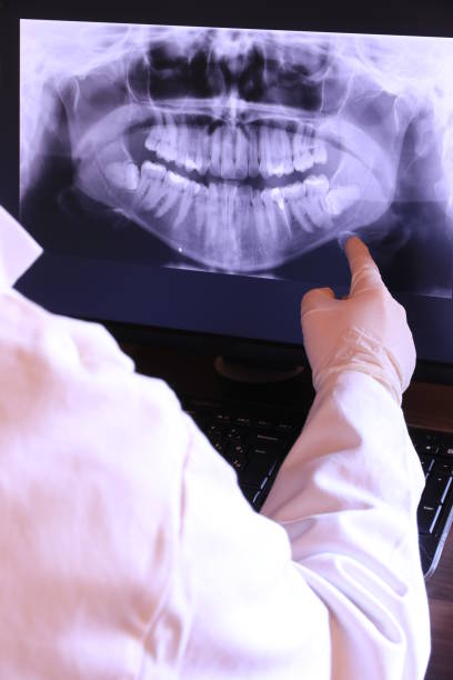 Best Emergency Root Canal Treatment in Cottonwood, AZ